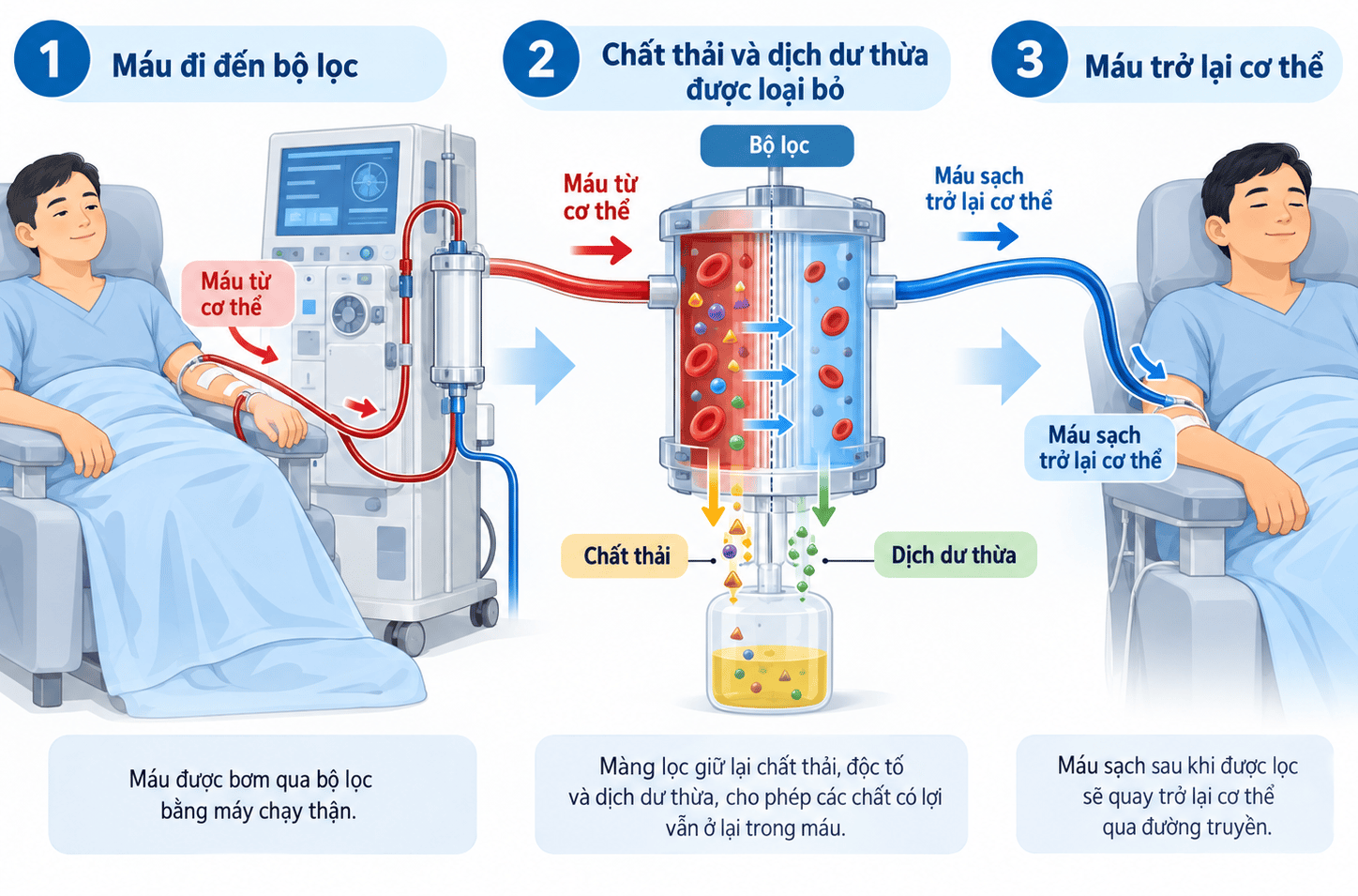 Sơ đồ nguyên lý hoạt động của phương pháp lọc máu bằng thận nhân tạo.